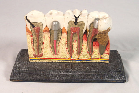 Vintage Mexico City Dental Model Sculpture